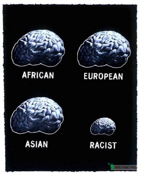 Rasizm. –  
