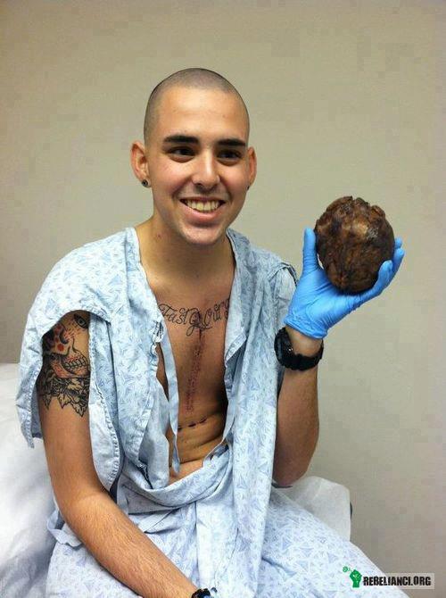 Człowiek po udanej transplantacji trzyma własne serce –  