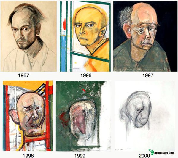 Alzheimer – Postęp choroby u artysty Williama Utermohlena utrwalony w jego pracach. 