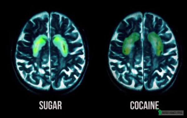 Cukier uzależnia niczym kokaina – Zbadano reakcje zachodzące w mózgu (szczególnie w rejonie nucleus accumbens czyli jądra półleżącego, odpowiedzialnego za nagrodę, przyjemność i uzależnienie) osób po spożyciu pokarmu zawierającego cukier i porównano z reakcjami tych, którzy używają kokainę.  Nie mam dla Was dobrych wieści, drodzy cukrożercy: cukier okazał się być substancją bardzo wredną – obliczono, iż uzależnia on aż osiem razy silniej niż kokaina.

Jak donosi dr Mark Hyman na łamach The Huffington Post, eksperyment wyglądał następująco: podano dwa koktajle, jeden o niskim indeksie glikemicznym (ok. 37) oraz drugi (po kilku dniach przerwy) identyczny w smaku i wyglądzie, posiadający taką samą ilość kalorii, białka, tłuszczu i węglowodanów, ale słodzony cukrem i w związku z tym posiadający indeks glikemiczny ok. 87. Tylko ten drugi wywołał wyraźną biologiczną reakcję w mózgu każdego z uczestników. Choć oba smakowały i wyglądały dokładnie tak samo. Uczestnicy eksperymentu nie wyczuli absolutnie żadnej różnicy pomiędzy jednym koktajlem a drugim. Jednak ich mózgi doskonale tę różnicę wyczuły!

Przypuszczalnie tak samo uzależniająco działają na nasz mózg również inne przetworzone pokarmy o wysokim indeksie glikemicznym: białe chrupiące bułeczki, krakersiki, drożdżóweczki, pączuszki, czipsiki czy fryteczki. Jak się człowiek do nich dorwie to trudno przestać, prawda?

Z drugiej strony równie wysoki indeks glikemiczny mają suszone daktyle (IG=103), banany są niewiele lepsze (IG=72). Niewinna fasolka szparagowa ma IG=71, a pasternak (często dodawany do kupnej włoszczyzny zamiast korzenia pietruszki) aż 95. Miód ma IG=87. Czy znasz jednak kogoś uzależnionego od daktyli, miodu lub bananów ? Śliniącego się na widok fasolki szparagowej? Przeszukującego w podnieceniu lodówkę w środku nocy w poszukiwaniu choćby marnego zasuszonego kawałka pasternaku? 

Jak widać cukier cukrowi nie jest równy. Uzależniające działanie ma głównie cukier dodany. Ten wytworzony ludzką ręką. Dary natury jakkolwiek słodkie by nie były i ilekolwiek naturalnie występujących cukrów by nie zawierały – nie mają na nas działania uzależniającego. O niebo zdrowiej i bezpieczniej jest wykorzystywać do słodzenia swoich deserów daktyle (np. zmielone na pastę) czy (tam gdzie się nie da użyć daktyli) należący do występujących w naturze polioli, erytrytol (który ma zerowy indeks glikemiczny, nie uzależnia, nie karmi candidy, nie psuje zębów itd.).

Jeśli zaś tkwisz w szponach cukrowego nałogu zaplanuj definitywne pożegnanie z cukrem czyli cukrowy detoks. Zrób to od ręki, od razu: zdrowie i witalność czekają! 